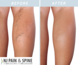  NJ Pain & Spine - Totowa, NJ 825 Riverview Dr., Floor 1 