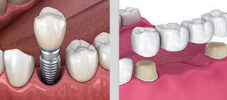 Profile Photos of Campsie Laser Dental Shop 21/94 Beamish St - Photo 2 of 6
