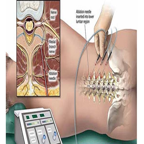  Profile Photos of Achilles Tendon Pain 8103 5th Ave, - Photo 2 of 5