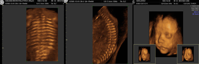  Profile Photos of Dr Seemaâ€™s Ultrasound Centre The Westside Clinic 33/1, East Patel Nagar - Photo 5 of 13