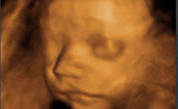  Dr Seemaâ€™s Ultrasound Centre The Westside Clinic 33/1, East Patel Nagar 