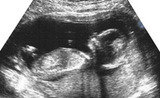  Dr Seemaâ€™s Ultrasound Centre The Westside Clinic 33/1, East Patel Nagar 