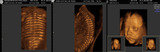  Dr Seemaâ€™s Ultrasound Centre The Westside Clinic 33/1, East Patel Nagar 