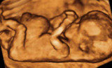  Dr Seemaâ€™s Ultrasound Centre The Westside Clinic 33/1, East Patel Nagar 