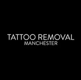 Tattoo Removal Manchester, Manchester