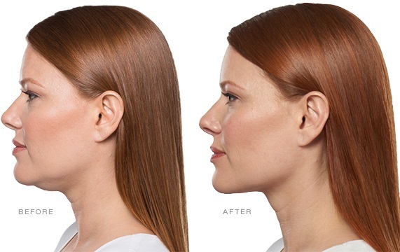  Profile Photos of Skin Savvy Advanced Aesthetics 12450 Wayzata Blvd, Suite 223 - Photo 1 of 5