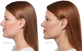 Skin Savvy Advanced Aesthetics, Minnetonka