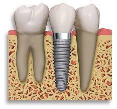 Dentist Delhi New Album of Dr. Jetley's Dental and Orthodontic Clinic C-225 Defence Colony - Photo 2 of 5