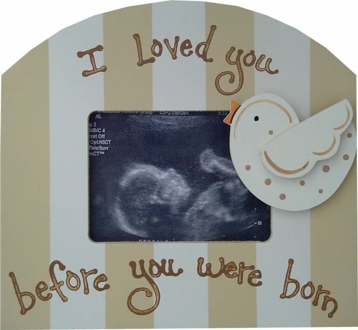  Profile Photos of Punkin Patch Interiors 21- 23 Elmfield Road - Photo 8 of 9