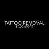 TATTOO REMOVAL STOCKPORT, Stockport