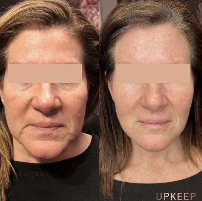  UPKEEP Before/After of UPKEEP 33 Bedford Street - Photo 1 of 1