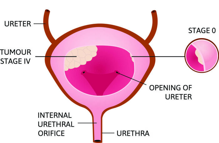  Profile Photos of Prostate Ultrasound And Biopsy 732 Rockaway Ave #4312 - Photo 1 of 4