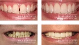  Triad Dentistry | Dental Implants Greensboro NC 2516 - A, Oakcrest Ave 