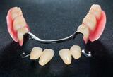 Mobile Denture Repair, Rainham