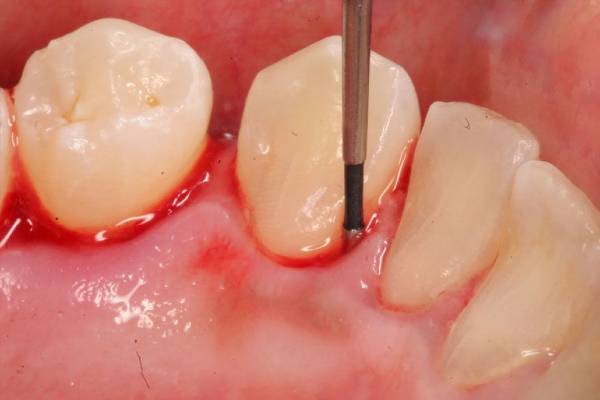  Profile Photos of Emergency Dentist of Grand Rapids 4362 Cascade Rd SE - Photo 2 of 4