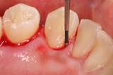 Emergency Dentist of Grand Rapids, Grand Rapids