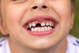 Emergency Dentist of Grand Rapids, Grand Rapids