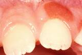 Emergency Dentist of Grand Rapids, Grand Rapids