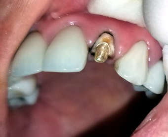  Profile Photos of Dental Fix 3350 W Hillsboro Blvd - Photo 2 of 7
