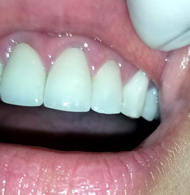 Profile Photos of Dental Fix 3350 W Hillsboro Blvd - Photo 3 of 7