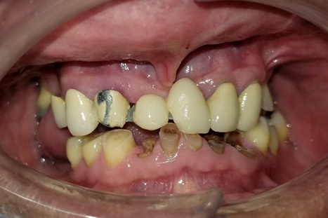  Profile Photos of Dental Fix 3350 W Hillsboro Blvd - Photo 5 of 7