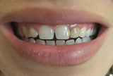  Dental Fix 3350 W Hillsboro Blvd 