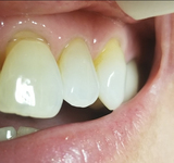 Dental Fix, Deerfield Beach
