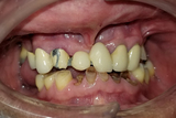Dental Fix, Deerfield Beach