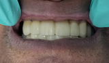 Dental Fix, Deerfield Beach
