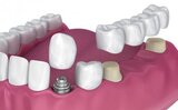 Leichhardt Street Dental Practice, Spring Hill