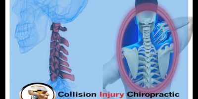  Profile Photos of Collision Injury Chiropractic | Car Accident Chiropractor 7562 N La Cholla Blvd - Photo 7 of 7