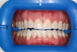 Mile High Smiles, Lakewood