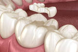  Shelburne Village Dental 125 Main St W 