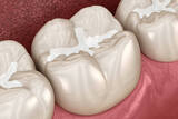  Shelburne Village Dental 125 Main St W 