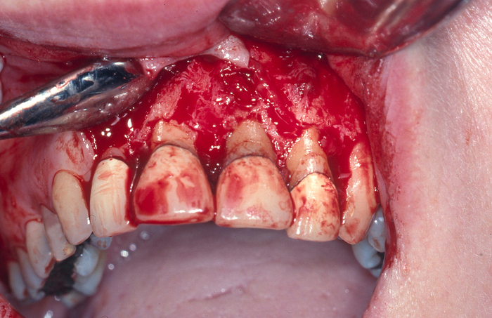  Profile Photos of Illawarra Oral and Maxillofacial Surgery 70 Bowral St - Photo 8 of 10