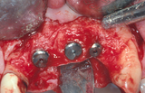  Illawarra Oral and Maxillofacial Surgery 70 Bowral St 