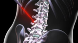  Advanced Spine Joint 5020 Victor Drive 