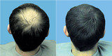  Marmm Klinik 6/1, Diamond Colony, Zanjeerwala Square, Opp. Agrawal Stores 