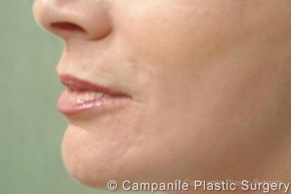  Profile Photos of Campanile Plastic Surgery 425 S. Cherry St. Suite #510 - Photo 2 of 5