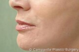 Campanile Plastic Surgery, Denver