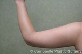 Campanile Plastic Surgery, Denver