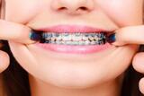  The Smile Store 4362 Northlake Blvd, Ste 114 