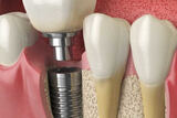  Blue Cedar Dentistry 121 N Main Ave 
