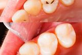  Blue Cedar Dentistry 121 N Main Ave 