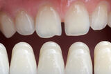  Blue Cedar Dentistry 121 N Main Ave 