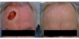 MetroDerm PC, Alpharetta