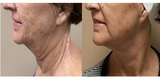 MetroDerm PC, Alpharetta