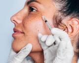 Precision Laser & Esthetics, Meridian