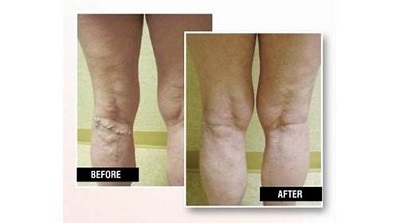  Profile Photos of USA Vein Clinics 5409 N State Rd 7 - Photo 3 of 4