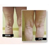 USA Vein Clinics, Vienna